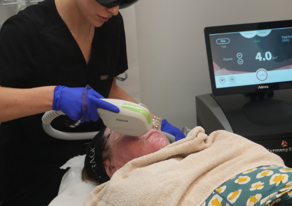 iPixel laser treatment skin resurfacing Cheshire ClearLift laser lunchtime facelift Sandbach IPL skin rejuvenation for pigmentation Cheshire Combination laser therapy Harmony XL Pro Sandbach