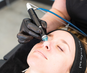 Hydrafacial at KAST